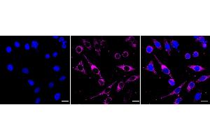 Immunocytochemical staining of HepG2 cells with SEC61A1/2 antibody (ABIN7800968), 1:1,000). (Recombinant SEC61A1/2 anticorps)