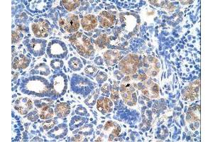anti-Fatty Acid Hydroxylase Domain Containing 2 (FAXDC2) (N-Term) antibody