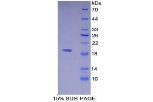 SDS-PAGE of Protein Standard from the Kit  (Highly purified E.