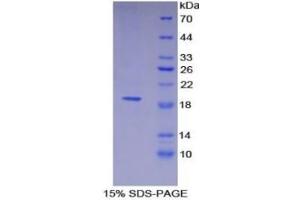SDS-PAGE of Protein Standard from the Kit  (Highly purified E. (Thrombomodulin Kit ELISA)