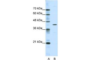 WB Suggested Anti-DOK2 Antibody Titration:  0. (DOK2 anticorps  (C-Term))