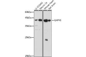 Western blot analysis of extracts of various cell lines, using G antibody (ABIN6127469, ABIN6140954, ABIN6140955 and ABIN6221997) at 1:1000 dilution. (GAP43 anticorps  (AA 1-238))