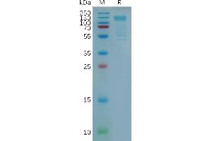 Human Protein, hFc Tag on SDS-PAGE under reducing condition.