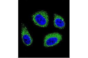 Confocal immunofluorescent analysis of DHCR7 Antibody (C-term) (ABIN655399 and ABIN2844946) with MCF-7 cell followed by Alexa Fluor 488-conjugated goat anti-rabbit lgG (green). (DHCR7 anticorps  (C-Term))