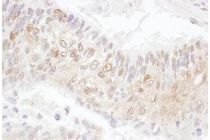 Immunohistochemistry (IHC) image for anti-Cyclin-Dependent Kinase 4 (CDK4) (AA 253-303) antibody (ABIN7455013) (CDK4 anticorps  (AA 253-303))