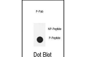 Dot blot analysis of anti-Phospho-Nephrin  antibody Phospho-specific Pab (ABIN650884 and ABIN2839827) on nitrocellulose membrane. (Nephrin anticorps  (pTyr1210))