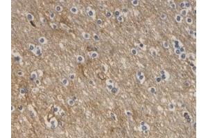 Detection of AQP4 in Human Cerebrum Tissue using Monoclonal Antibody to Aquaporin 4 (AQP4)