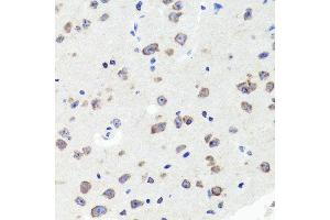 Immunohistochemistry of paraffin-embedded mouse brain using DLG1 antibody (ABIN5996451) at dilution of 1/100 (40x lens). (DLG1 anticorps)