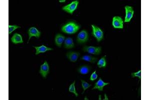 Immunofluorescence staining of A549 cells with ABIN7161414 at 1:166, counter-stained with DAPI. (NPY2R anticorps  (AA 326-381))