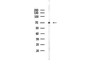 anti-Far Upstream Element (FUSE) Binding Protein 1 (FUBP1) (C-Term) antibody
