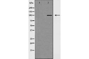 Western blot analysis of extracts from HeLa cells using MKL1 antibody. (MKL1 anticorps  (N-Term))