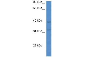 Western Blot showing MTNR1A antibody used at a concentration of 1 ug/ml against Jurkat Cell Lysate