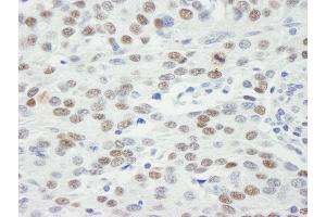 Immunohistochemistry (IHC) image for anti-Mdc1 (MDC1) (AA 1375-1425) antibody (ABIN7448658) (MDC1 anticorps  (AA 1375-1425))