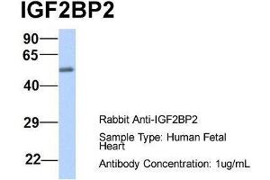 Host:  Rabbit  Target Name:  IGF2BP2  Sample Type:  Human Fetal Heart  Antibody Dilution:  1.
