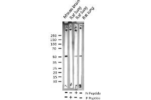 Western blot analysis of Phospho-GSK3 alpha (Ser21) expression in various lysates (GSK3 alpha anticorps  (pSer21))