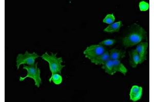 Immunofluorescent analysis of MCF-7 cells using ABIN7162218 at dilution of 1:100 and Alexa Fluor 488-congugated AffiniPure Goat Anti-Rabbit IgG(H+L)