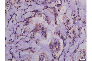 Formalin-fixed and paraffin embedded rat intestine labeled with Anti-ATG101 Polyclonal Antibody, Unconjugated  at 1:300 followed by conjugation to the secondary antibody and DAB staining. (ATG101 anticorps  (AA 121-218))