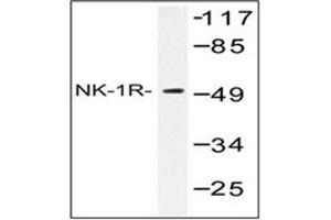Image no. 1 for anti-Tachykinin Receptor 1 (TACR1) antibody (ABIN317654) (TACR1 anticorps)
