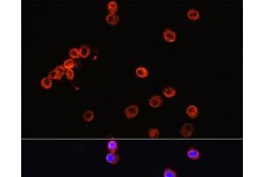Immunofluorescence analysis of RAW264. (CD3 epsilon anticorps)