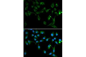 Immunofluorescence analysis of U2OS cells using TOLLIP antibody. (TOLLIP anticorps)