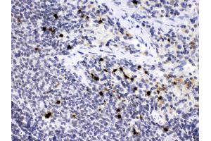 Elastase/ELANE/ELA2 was detected in paraffin-embedded sections of rat spleen tissues using rabbit anti- Elastase/ELANE/ELA2 Antigen Affinity purified polyclonal antibody (Catalog # ) at 1 ?