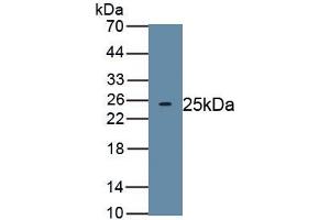 Detection of Recombinant TITF1, Human using Polyclonal Antibody to Thyroid Transcription Factor 1 (TITF1)