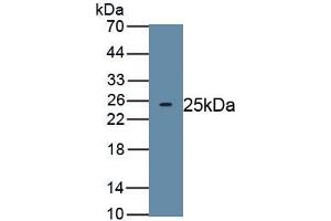 Detection of Recombinant TITF1, Human using Polyclonal Antibody to Thyroid Transcription Factor 1 (TITF1) (NKX2-1 anticorps)