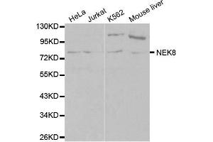 Western blot analysis of extracts of various cell lines, using NEK8 antibody (ABIN5970372) at 1/1000 dilution.
