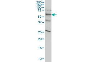 STK33 monoclonal antibody (M02), clone 6G1 Western Blot analysis of STK33 expression in HeLa .