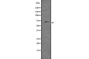 Western blot analysis of GLIS1 using HT29 whole  lysates. (GLIS1 anticorps  (N-Term))