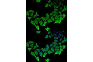 Immunofluorescence analysis of HeLa cell using APLP1 antibody. (APLP1 anticorps)