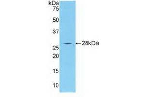 Western blot analysis of recombinant Human IRAK4. (IRAK4 anticorps  (AA 189-427))