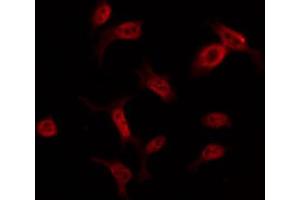 ABIN6274555 staining COLO205 by IF/ICC. (YBX2 anticorps  (C-Term))