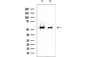 Western blot analysis of lysates from various samples, using Src Mouse Monoclonal Antibody at 1/1000 dilution.