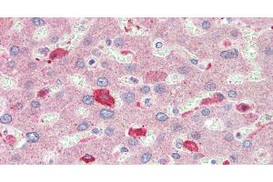 Immunohistochemistry of paraffin-embedded Liver tissue using BCAT1 Polyclonal Antibody at dilution of 1:100. (BCAT1 anticorps)
