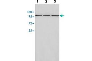 Western blot analysis of HepG2 (Lane 1), human fetal liver (Lane 2) and brain lysate (Lane 3) with CTNNA2 polyclonal antibody  at 1:500 dilution. (CTNNA2 anticorps)