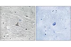 Immunohistochemistry analysis of paraffin-embedded human brain tissue, using VHL (Ab-68) Antibody. (VHL anticorps  (AA 34-83))