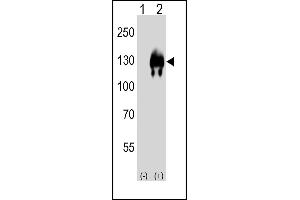 Western blot analysis of (arrow) using rabbit polyclonal EN Antibody (Center) (ABIN650746 and ABIN2839471). (ENPP2 anticorps  (AA 377-406))