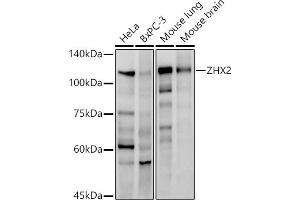anti-Zinc Fingers and Homeoboxes 2 (ZHX2) antibody