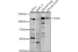 Western blot analysis of extracts of various cell lines, using ZHX2 antibody (ABIN7271565) at 1:1000 dilution. (ZHX2 anticorps)