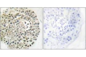 Immunohistochemistry analysis of paraffin-embedded human testis, using TRIM16 Antibody. (TRIM16 anticorps  (AA 31-80))