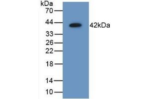 Detection of Recombinant AIMP1, Mouse using Polyclonal Antibody to Aminoacyl tRNA Synthetase Complex Interacting Multifunctional Protein 1 (AIMP1) (AIMP1 anticorps  (AA 2-310))