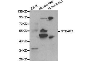 Western blot analysis of extracts of various cell lines, using STEAP3 antibody. (STEAP3 anticorps  (AA 1-180))