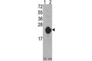 Western blot analysis of IL1RN (arrow) using rabbit polyclonal IL1RN Antibody (Center) .
