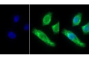 Detection of CK10 in Human Hela cell using Polyclonal Antibody to Cytokeratin 10 (CK10)