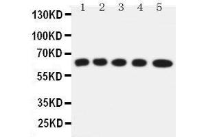 Anti-Solute carrier family 22 member 5 antibody, Western blotting Lane 1: Rat Kidney Tissue Lysate Lane 2: Rat Skeletal Muscles Tissue Lysate Lane 3: Mouse Liver Tissue Lysate Lane 4: HEPA Cell Lysate Lane 5: NIH3T3 Cell Lysate (SLC22A5 anticorps  (C-Term))
