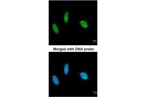 ICC/IF Image Immunofluorescence analysis of paraformaldehyde-fixed HeLa, using RBM15, antibody at 1:200 dilution.