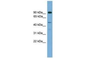 Image no. 1 for anti-Zinc Finger Protein 2, Y Linked (ZFY2) (AA 251-300) antibody (ABIN6744556) (ZFY2 anticorps  (AA 251-300))