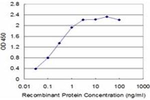 Detection limit for recombinant GST tagged SLC11A1 is approximately 0.