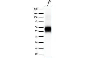 Western Blot of human lung lysate using EpCAM Rabbit Recombinant Monoclonal Antibody (EGP40/2041R).